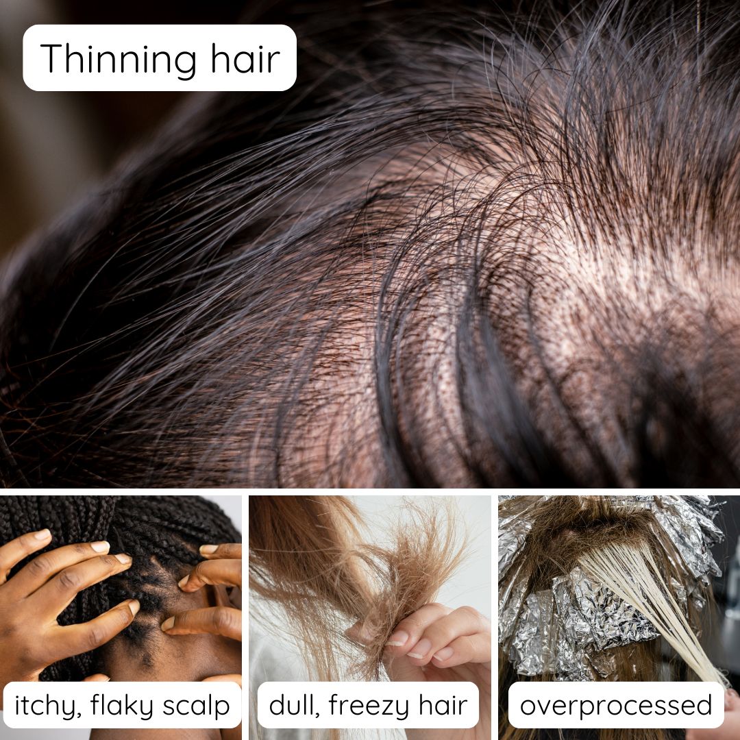 Hair Boost - Herbal Hair Growth Oil